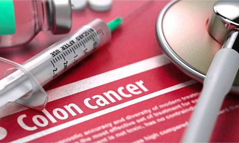 Colorectal Cancer believed to be a Serious Threat to the Nation