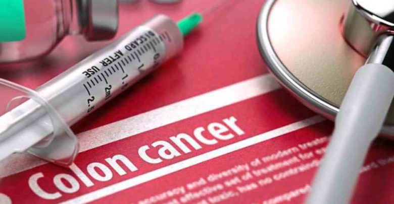 Colorectal Cancer believed to be a Serious Threat to the Nation