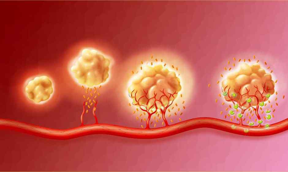 The way to Amalgamate Cancer Care